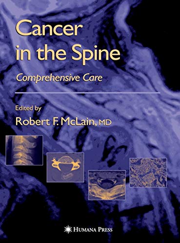Stock image for Cancer in the Spine: Comprehensive Care for sale by Book Bear