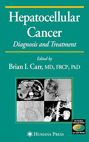 Beispielbild fr Hepatocellular Carcinoma Diagnosis and Treatment zum Verkauf von Buchpark