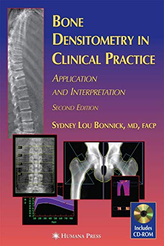 Stock image for Bone Densitometry in Clinical Practice: Application and Interpretation (Current Clinical Practice) for sale by Byrd Books