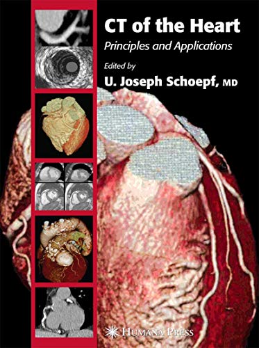 9781588293039: CT of the Heart: Principles and Applications
