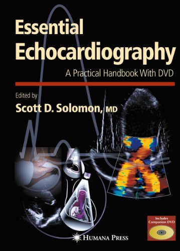 9781588293220: Essential Echocardiography: A Practical Guide With DVD (Contemporary Cardiology)