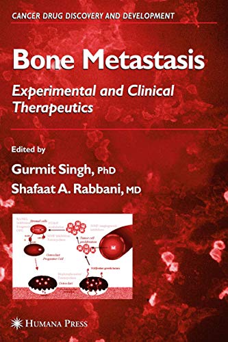 9781588294036: Bone Metastasis (Cancer Drug Discovery and Development)