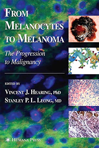 Stock image for From Melanocytes to Melanoma: The Progression to Malignancy for sale by GF Books, Inc.