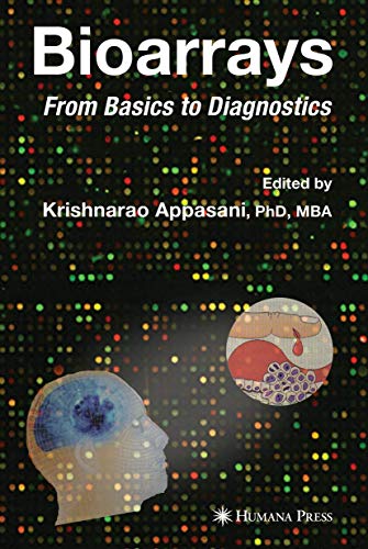 Imagen de archivo de Bioarrays: From Basics to Diagnostics a la venta por Books From California