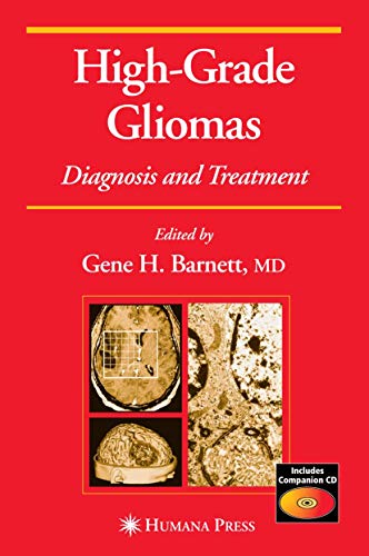 9781588295118: High-Grade Gliomas: Diagnosis and Treatment (Current Clinical Oncology)