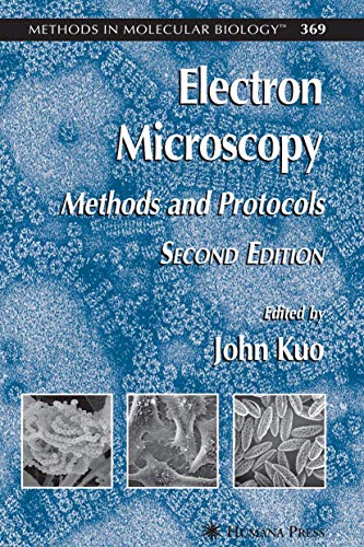 Stock image for Electron Microscopy: Methods and Protocols for sale by Anybook.com