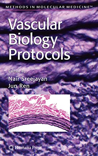 9781588295743: Vascular Biology Protocols: 139 (Methods in Molecular Medicine)