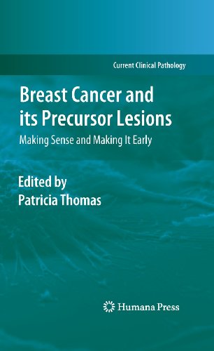 Stock image for Breast Cancer and Its Precursor Lesions: Making Sense and Making It Early for sale by Blackwell's