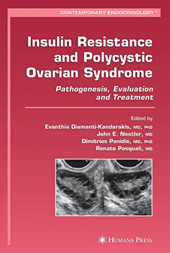 Stock image for Insulin Resistance And Polycystic Ovarian Syndrome: Pathogenesis, Evaluation, And Treatment for sale by Basi6 International