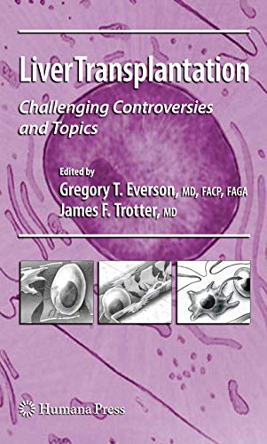 Stock image for Liver Transplantation: Challenging Controversies and Topics (Clinical Gastroenterology) for sale by Bookmans