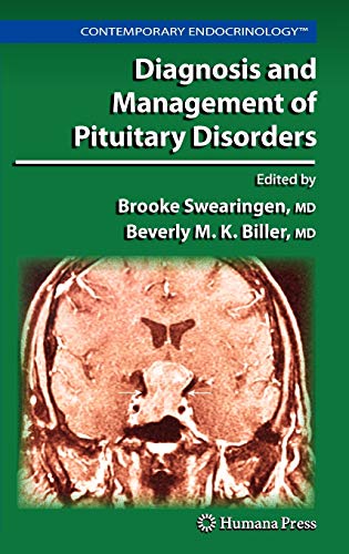 9781588299222: Diagnosis and Management of Pituitary Disorders (Contemporary Endocrinology)