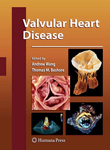 9781588299826: Valvular Heart Disease (Contemporary Cardiology)