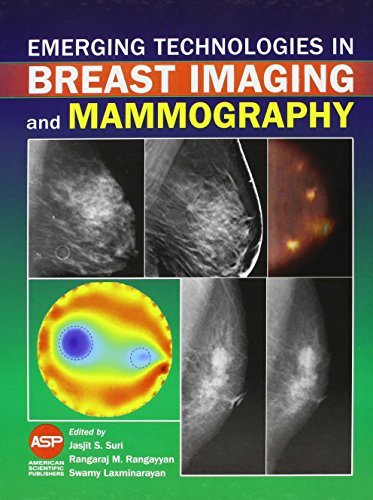 Imagen de archivo de Emerging Technologies in Breast Imaging and Mammography a la venta por Books Puddle