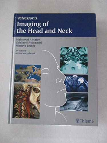 Beispielbild fr Imaging of the Head and Neck zum Verkauf von ThriftBooks-Dallas