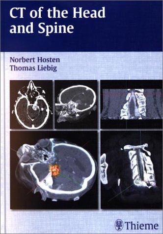 Beispielbild fr CT of the Head and Spine zum Verkauf von HPB-Red