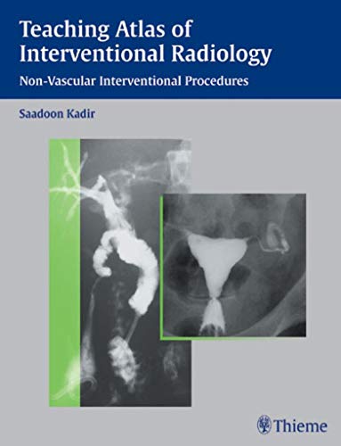 Imagen de archivo de Teaching Atlas of Interventional Radiology a la venta por Books Puddle
