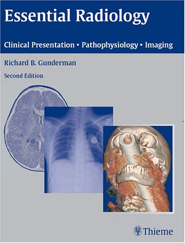 Beispielbild fr Essential Radiology : Clinical Presentation - Pathophysiology - Imaging zum Verkauf von Better World Books