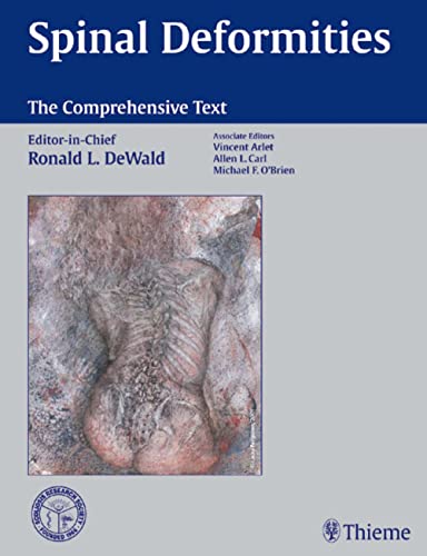 9781588900890: Spinal Deformities: The Comprehensive Text