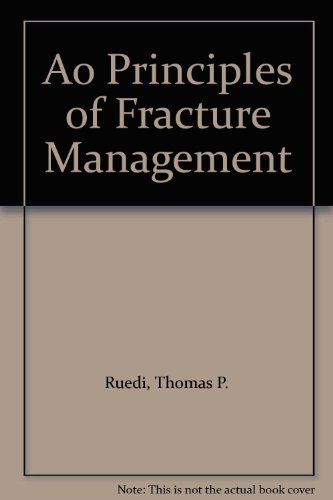 9781588900982: Ao Principles of Fracture Management