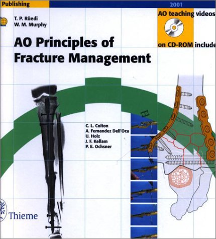 AO Principles of Fracture Management (Book with CD-ROMs + DVD) (9781588901088) by Ruedi, Thomas P.; Murphy, William M.