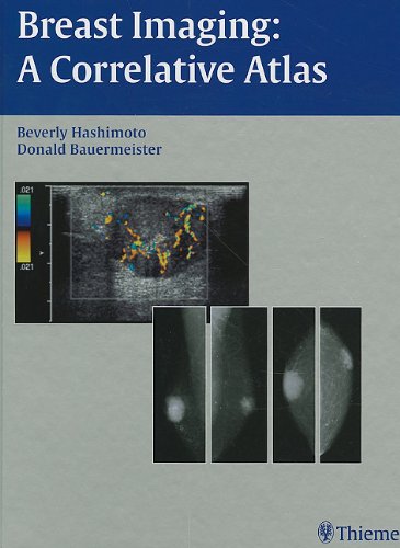 9781588901095: Breast Imaging: A Correlative Atlas