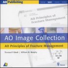 AO Image Collection: AO Principles of Fracture Management (9781588901354) by Ruedi, Thomas P.; Murphy, William M.