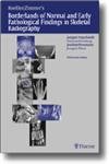 9781588901507: Koehler/Zimmer's Borderlands of Normal and Early Pathological Findings in Skeletal Radiography