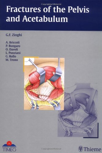 9781588901644: Fractures of the Pelvis and Acetabulum