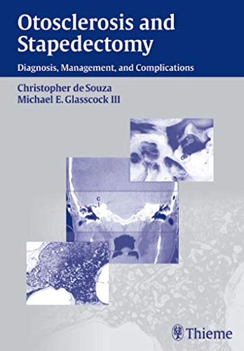 9781588901699: Otosclerosis and Stapedectomy: Diagnosis, Management, and Complications: Diagnosis, Management & Complications