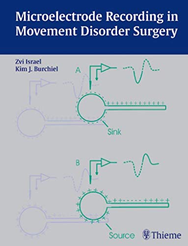 Stock image for Microelectrode Recording in Movement Disorder Surgery for sale by Books Puddle