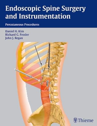 Stock image for Endoscopic Spine Surgery and Instrumentation for sale by Books Puddle