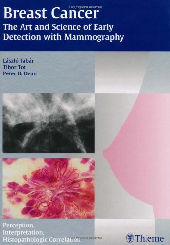 Beispielbild fr Breast Cancer: The Art And Science Of Early Detection With Mamography: Perception, Interpretation, Histopatholigic Correlation zum Verkauf von ThriftBooks-Dallas