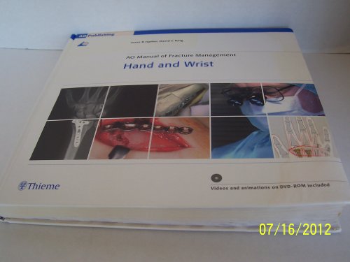 Beispielbild fr Ao Manual of Fracture Management: Hand & Wrist zum Verkauf von Lost Books