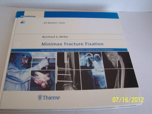Stock image for Minimax Fracture Fixation: Case Collection: Lower leg - ankle joint - nonunions - autogenous bone transplantation (AO Master Series) for sale by dsmbooks