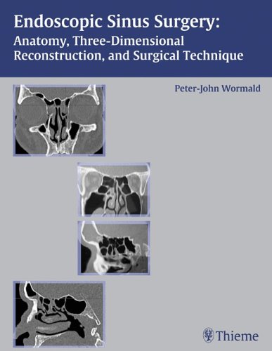 9781588902856: Endoscopic Sinus Surgery: Anatomy, Three-Dimensional Reconstruction, And Surgical Technique