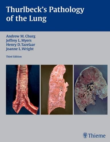 9781588902887: Thurlbeck's Pathology Of The Lung