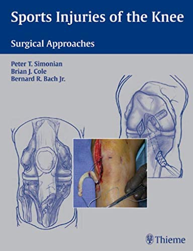 9781588903068: Sports Injuries of the Knee: Surgical Approaches
