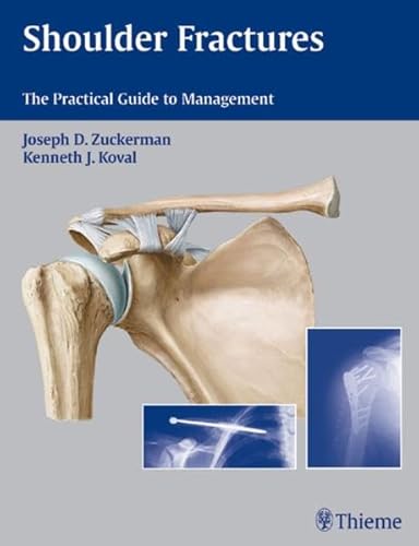 9781588903105: Shoulder Fractures: The Practical Guide To Management