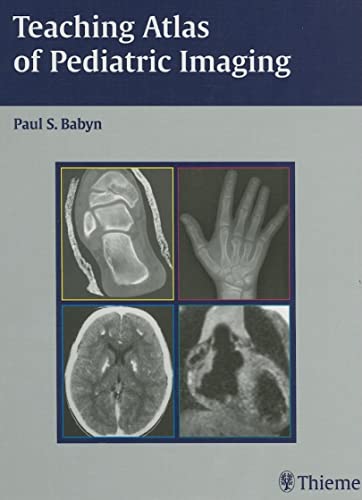 Stock image for Teaching Atlas of Pediatric Imaging (Teaching Atlas) for sale by Revaluation Books