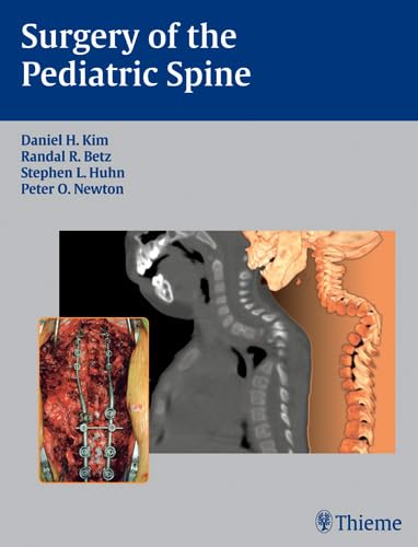 9781588903426: Surgery of the Pediatric Spine