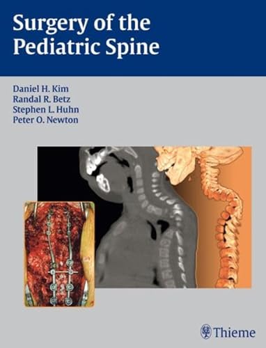 Stock image for Surgery of the Pediatric Spine for sale by GF Books, Inc.