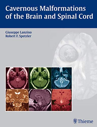 Imagen de archivo de Cavernous Malformations of the Brain and Spinal Cord a la venta por Books Unplugged