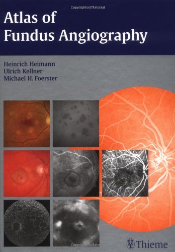 Imagen de archivo de Atlas of Fundus Angiography a la venta por dsmbooks