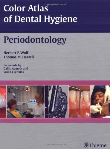 9781588904409: Color Atlas of Dental Hygiene: Periodontology