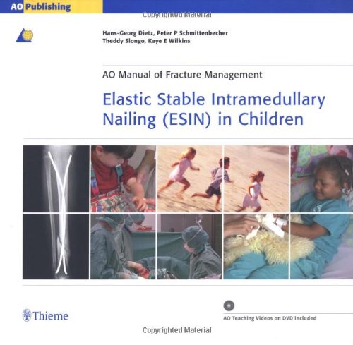 Stock image for Elastic Stable Intramedullary Nailing Esin in Children (Ao Manual of Fracture Management Series) for sale by -OnTimeBooks-