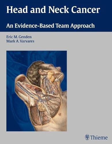 Stock image for Head and Neck Cancer : An Evidence-Based Team Approach for sale by Better World Books Ltd