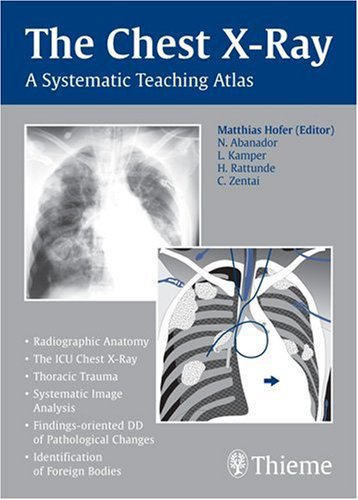 Beispielbild fr The Chest X-Ray zum Verkauf von medimops