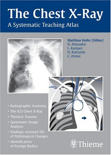 9781588905543: The Chest X-Ray: A Systematic Teaching Atlas