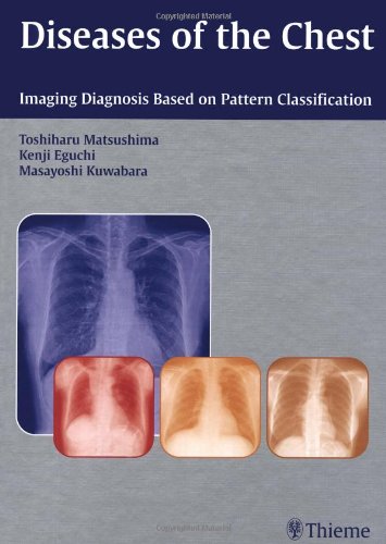 Stock image for Diseases of the Chest: Imaging Diagnosis Based on Pattern Classification for sale by HPB-Red