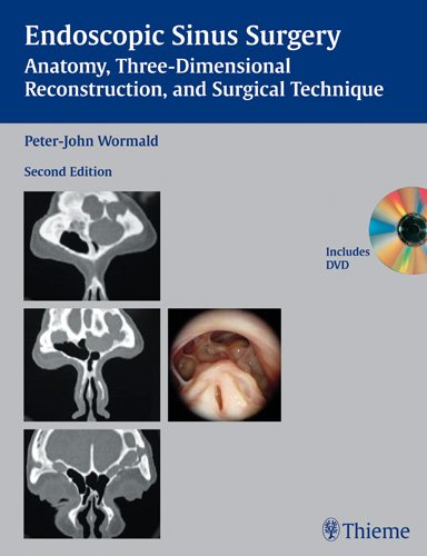9781588906038: Endoscopic Sinus Surgery: Anatomy, Three-Dimensional Reconstruction, and Surgical Technique